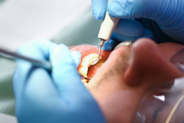 Best Emergency Treatment for Toothache in Fairfax, OH